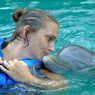 SCART